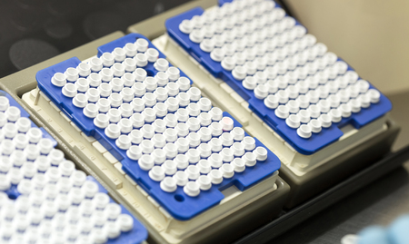 A set of glass tubes for samples. Laboratory chemical equipment. Analyzes.の写真素材