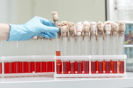 Hand of a lab technician holding blood tube test and background a rack of tubes with blood samples...