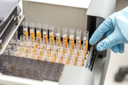 set of Test tubes in the laboratoryの写真素材