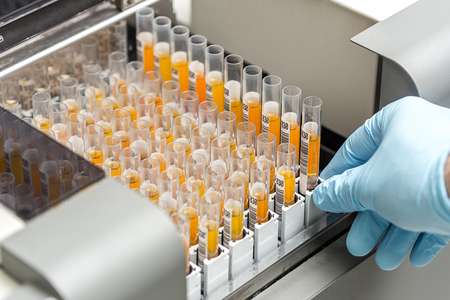 set of Test tubes in the laboratory