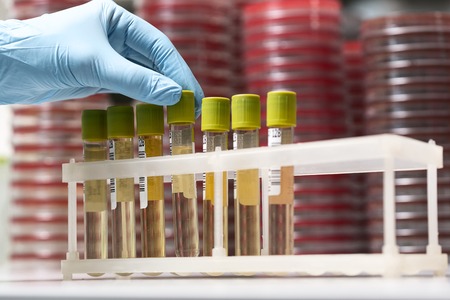 Test-tubes with yellow liquid in the laboratoryの写真素材