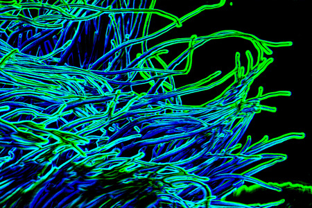Neon glowing abstract from natural coralの写真素材