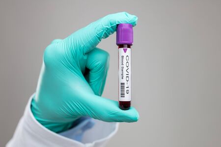Doctor wearing respiratory mask and holding the Coronavirus Covid-19 blood sample の写真素材