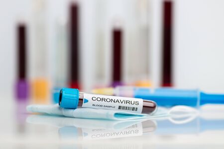 Testing the laboratory sample of the novel Coronavirusの写真素材
