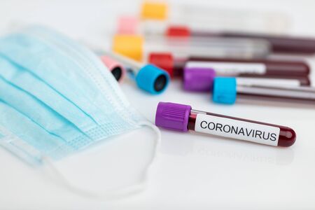 Testing the laboratory sample of the novel Coronavirusの写真素材