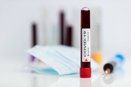 Testing the laboratory sample of the novel Coronavirusの写真素材