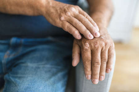 Elderly man suffering from psoriasis, closeup on handsの写真素材