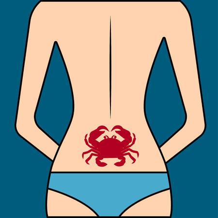 Lumbago - pain in lumbar. Back of woman with sick spine. - Stock vectorのイラスト素材