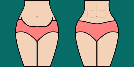 Body before and after weight loss. Woman with fat belly and girl with amazing abs, toned abdominal muscles. Vector illustrationのイラスト素材