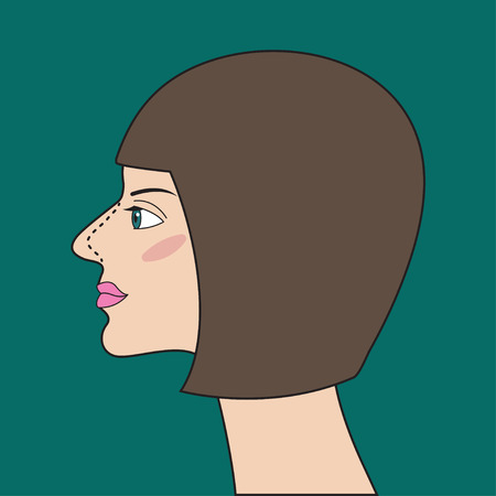 Rhinoplasty, nose plastic surgery, aesthetic medicine Vector illustrationのイラスト素材