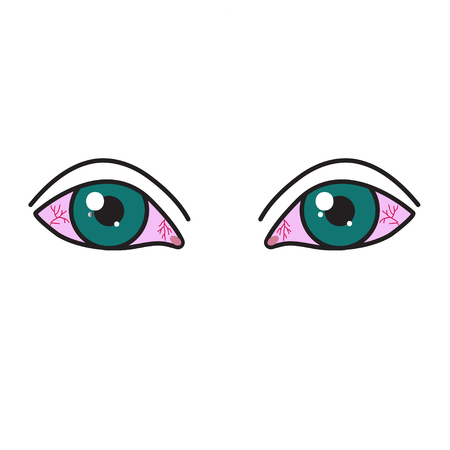 Sore eyes, inflamed reddened eyes, red eyes icon. Vector illustrationのイラスト素材