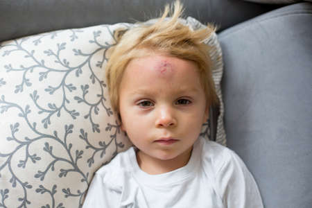 Toddler boy, lying on the couch at home with big bump on the forehead after falling from a swing