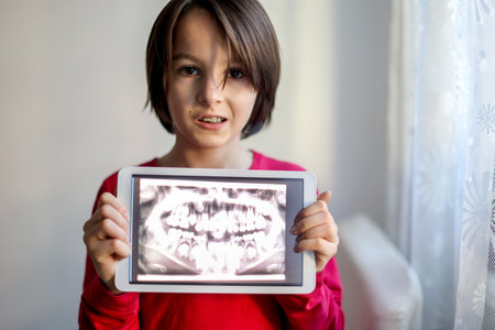 Child, wearing braces, preteen boy, holding tablet with a picture of his x-ray teeth from the dentistof him at homeの写真素材