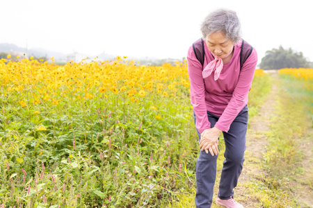 Senior woman with knee pain while hiking in the parkの写真素材