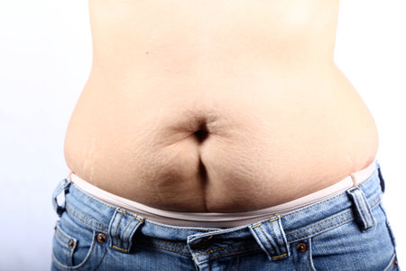 Close-up stomach of woman