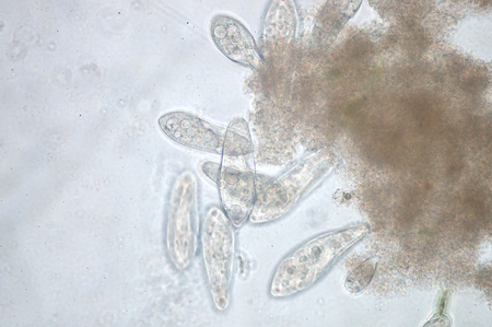 Paramecium is a genus of unicellular ciliated protozoa,  Paramecia are widespread in freshwater,...