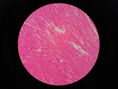 Histology of human cardiac muscle under microscope viewの写真素材
