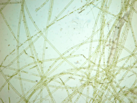 Filamentous algae are single algae cells that form long visible chains, threads, or filaments.