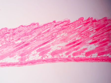 Cross section human skin tissue under microscope viewの写真素材