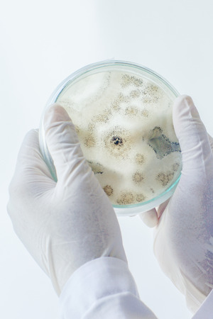 Scientist show colony of fungus (Asperillus niger) in culture medium plate, Microbiology.の写真素材