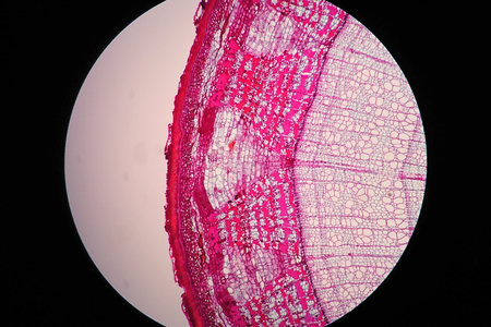 Cross sections of plant stem under microscope viewの写真素材
