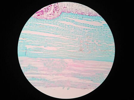 Plant stem, long section under microscope view