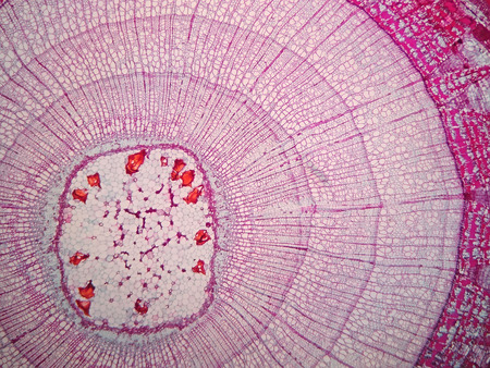 Cross sections of  plant stem under microscope view