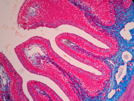 Histology of human intestine tissue under microscope viewの写真素材