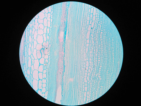 Plant stem, long section under microscope viewの写真素材