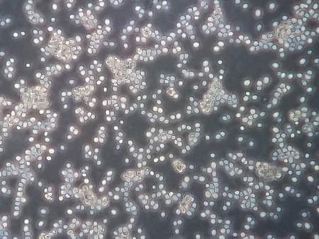 Yeast cells under microscope viewの写真素材