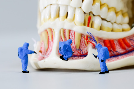 Miniature people scientist at work with dental tooth model