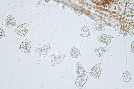 Vorticella is a genus of protozoan under the microscope view.の写真素材