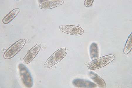 Tetrahymena is a genus of unicellular ciliated protozoan and Bacterium under the microscopeの写真素材