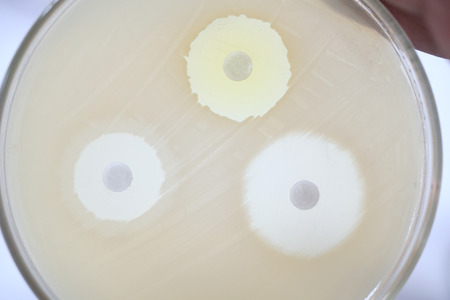 Antibiotic sensitivity of bacteria by means of diffusion test is a test. Microbiology