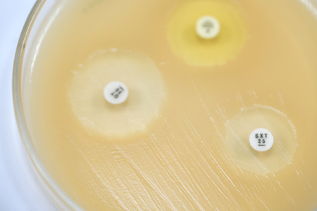 Antibiotic sensitivity of bacteria by means of diffusion test is a test. Microbiology
の写真素材