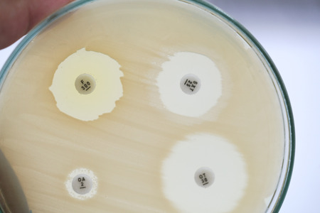 Antibiotic sensitivity of bacteria by means of diffusion test is a test. Microbiologyの写真素材
