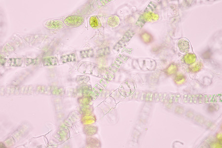 Filamentous algae are single algae cells that form long visible chains, threads, or filaments.