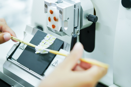 Rotary Microtome Section for diagnosis in pathology make microscope slide histology. Human tissue equipmentの写真素材