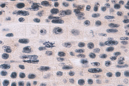 Root tip of Onion and Mitosis cell in the Root tip for education