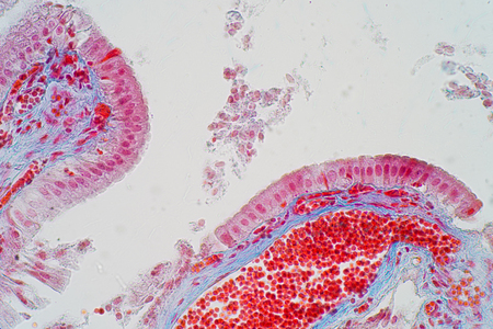 simple columnar epithelium is a columnar epithelium that is uni-layered. In humans, a simple...