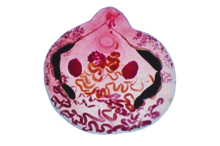 Liver fluke(Parasitic flatworm) of cattle and other grazing animals.