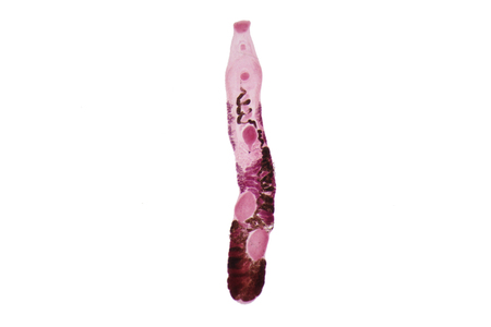Liver fluke(Parasitic flatworm) of cattle and other grazing animals.