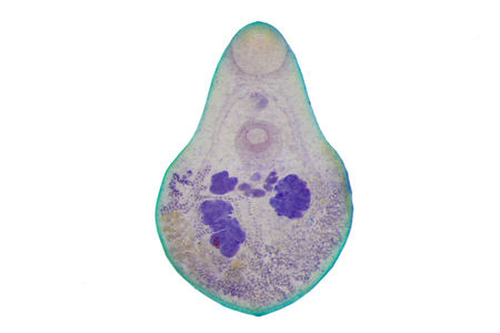Liver fluke(Parasitic flatworm) of cattle and other grazing animals.