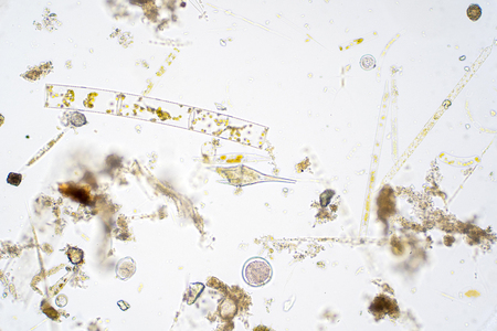 Marine aquatic plankton under the microscope view.の写真素材