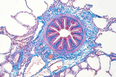 Human lung tissue under microscope view. Lungs are the primary organs of the respiratory system in...