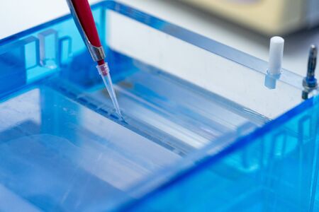 Molecular technique gel electrophoresis for DNA sample method decrypt the genetic code. biochemistry and clinical chemistry in laboratory.の写真素材