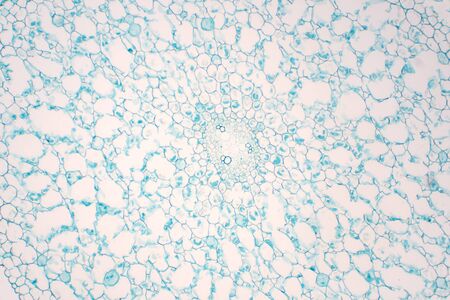 Cross sections of plant root under microscope view for education plant physiology.