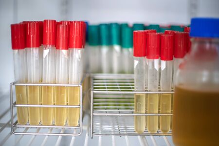Test tube for bacterial culture in the cool incubator laboratory.