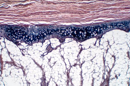 Human hyaline cartilage bone under microscope view for education pathology. Human tissue phisiology.