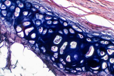 Human hyaline cartilage bone under microscope view for education pathology. Human tissue phisiology.の写真素材